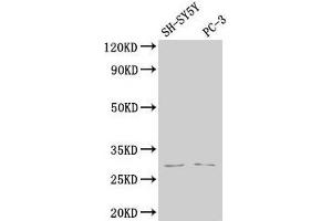 Western Blot Positive WB detected in: SH-SY5Y whole cell lysate, PC-3 whole cell lysate All lanes: APH1B antibody at 1:2000 Secondary Goat polyclonal to rabbit IgG at 1/50000 dilution Predicted band size: 29, 25 kDa Observed band size: 29 kDa (APH1B Antikörper  (AA 93-110))