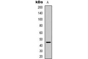 Western blot analysis of ARRDC2 expression in HEK293T (A) whole cell lysates. (ARRDC2 Antikörper)