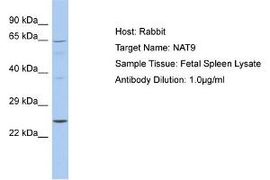Host: Rabbit Target Name: NAT9 Sample Tissue: Human Fetal Spleen Antibody Dilution: 1ug/ml