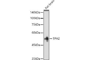 Western blot analysis of extracts of various cell lines, using TET3 antibody (ABIN6133174, ABIN6149021, ABIN6149023 and ABIN6223527) at 1:1000 dilution. (Tryptophan Hydroxylase 2 Antikörper  (AA 1-170))
