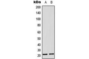Western blot analysis of MRPL11 expression in A431 (A), HepG2 (B) whole cell lysates. (MRPL11 Antikörper  (Center))