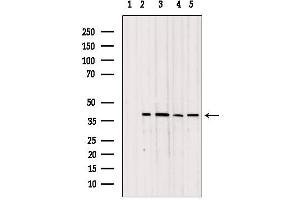 Western blot analysis of extracts from various samples, using TOM40 antibody. (TOMM40 Antikörper  (Internal Region))