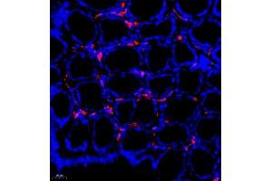 Immunofluorescence of paraffin embedded rat colon using MHC-II (ABIN7074245) at dilution of 1:500 (400x lens) (CD74 Antikörper)