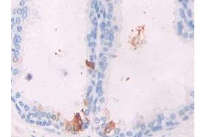 DAB staining on IHC-P; Samples: Human Prostate Tissue (GREM1 Antikörper  (AA 26-184))