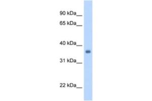 Western Blotting (WB) image for anti-Sarcoglycan, gamma (35kDa Dystrophin-Associated Glycoprotein) (SGCG) antibody (ABIN2462796)