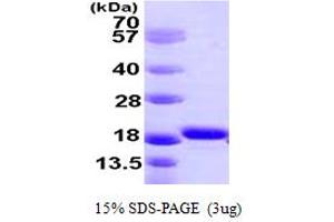 SDS-PAGE (SDS) image for Ionized Calcium-binding Adapter Molecule 1 (IBA1) (AA 1-147) protein (His tag) (ABIN667414)