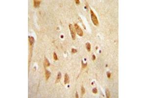 Immunohistochemistry analysis in formalin fixed and paraffin embedded human brain tissue reacted with MAPK8 / JNK1 Antibody (Thr183/Tyr185) followed which was peroxidase conjugated to the secondary antibody and followed by DAB staining. (JNK Antikörper  (AA 162-199))