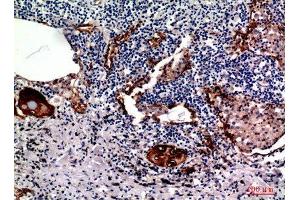Immunohistochemistry (IHC) image for anti-Mucin 1 (MUC1) (Internal Region) antibody (ABIN6280749)
