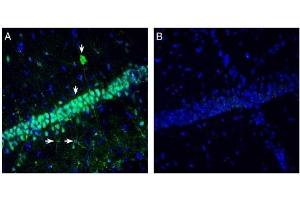 Expression of Neuromedin U Receptor 2 in rat hippocampus. (NMUR2 Antikörper  (Extracellular, N-Term))