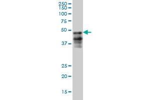 FOXA2 monoclonal antibody (M05), clone 6G9 Western Blot analysis of FOXA2 expression in HepG2 . (FOXA2 Antikörper  (AA 363-457))