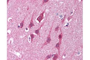 Anti-MRE11A / MRE11 antibody IHC of human brain, cortex.