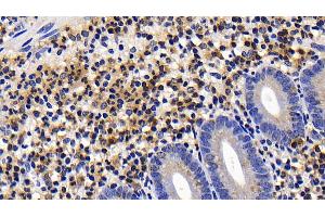 Detection of CASP9 in Human Appendix Tissue using Polyclonal Antibody to Caspase 9 (CASP9)