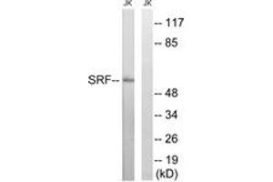 Western blot analysis of extracts from Jurkat cells, treated with insulin 0. (SRF Antikörper  (AA 41-90))