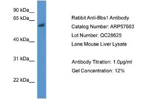 WB Suggested Anti-Bbs1  Antibody Titration: 0.