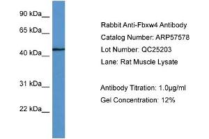 WB Suggested Anti-Fbxw4  Antibody Titration: 0.