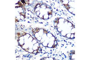 Immunohistochemistry of paraffin-embedded human colon using Peroxiredoxin 3 (PRDX3) (PRDX3) Rabbit mAb (ABIN7269237) at dilution of 1:100 (40x lens). (Peroxiredoxin 3 Antikörper)