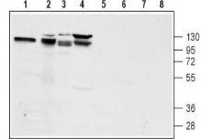 Western blot analysis of rat pancreas lysate (lanes 1 and 5), mouse preadipocyte 3T3-L1 lysate (lanes 2 and 6), rat pancreatic islet cell line  lysate (lanes 3 and 7) and human pancreatic carcinoma  lysate (lanes 4 and 8):1-4. (Glucagon-Like Peptide 1 Receptor (GLP1R) Peptid)