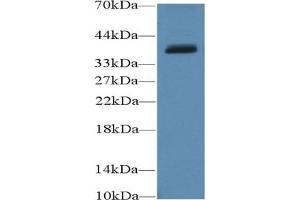 Detection of UCP4 in Porcine Cerebrum lysate using Polyclonal Antibody to Uncoupling Protein 4, Mitochondrial (UCP4) (SLC25A27 Antikörper  (AA 21-317))