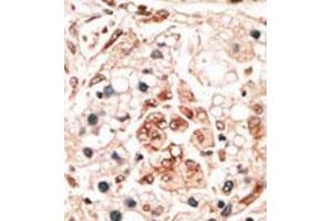 Image no. 2 for anti-Hippocalcin (HPCA) (N-Term) antibody (ABIN357112) (Hippocalcin Antikörper  (N-Term))