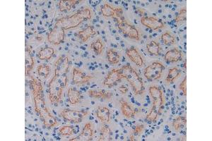 Used in DAB staining on fromalin fixed paraffin- embedded kidney tissue (CD320 Antikörper  (AA 36-256))