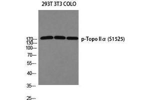 Western Blot (WB) analysis of 293T 3T3 COLO205 using p-Topo IIalpha (S1525) antibody. (Topo IIalpha (pSer1525) Antikörper)