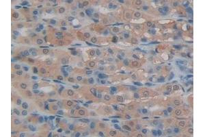 DAB staining on IHC-P; Samples: Rat Intestine Tissue (LCN8 Antikörper  (AA 25-176))