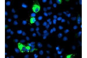 Anti-CYP2J2 mouse monoclonal antibody (ABIN2454990) immunofluorescent staining of COS7 cells transiently transfected by pCMV6-ENTRY CYP2J2 (RC207417). (CYP2J2 Antikörper)