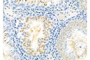 ABIN6260299 and ABIN6277920 at 1/100 staining Rat testis tissue by IHC-P. (BSP Antikörper  (Internal Region))