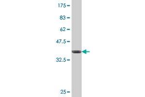 Western Blotting (WB) image for anti-Cytochrome P450, Family 2, Subfamily C, Polypeptide 18 (CYP2C18) (AA 200-299) antibody (ABIN560546)