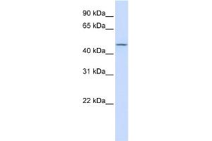 WB Suggested Anti-CHST6 Antibody Titration:  0. (CHST6 Antikörper  (Middle Region))