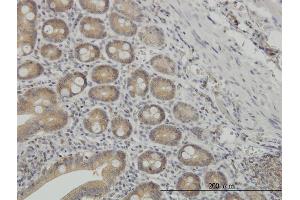 Immunoperoxidase of monoclonal antibody to NMI on formalin-fixed paraffin-embedded human small Intestine. (NMI Antikörper  (AA 1-100))