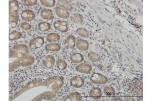 Immunoperoxidase of monoclonal antibody to NMI on formalin-fixed paraffin-embedded human small Intestine.