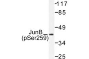 Image no. 1 for anti-Jun B Proto-Oncogene (JUNB) (pSer259) antibody (ABIN318057) (JunB Antikörper  (pSer259))