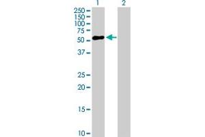 Western Blot analysis of ZNF436 expression in transfected 293T cell line by ZNF436 MaxPab polyclonal antibody. (ZNF436 Antikörper  (AA 1-470))