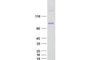 Validation with Western Blot