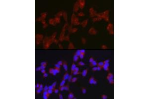 Immunofluorescence analysis of SH-SY5Y cells using A Rabbit pAb (ABIN7265712) at dilution of 1:150 (40x lens). (ATG9A Antikörper  (AA 180-290))