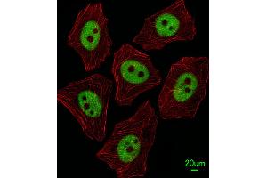 Immunofluorescent analysis of A549 cells, using XRCC1 Antibody . (XRCC1 Antikörper  (AA 407-435))