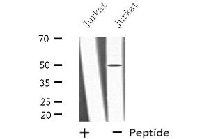 Western blot analysis of extracts from Jurkat cells, using LRP11 antibody. (LRP11 Antikörper  (Internal Region))