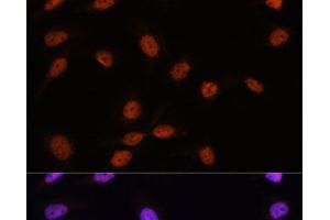 Immunofluorescence analysis of U-2 OS cells using SRSF7 Polyclonal Antibody at dilution of 1:100. (SFRS7 Antikörper)