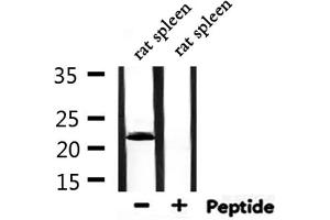 Western blot analysis of extracts from rat spleen, using MYL3 Antibody. (MYL3/CMLC1 Antikörper  (Internal Region))