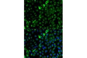 Immunofluorescence analysis of A-549 cells using Cytokeratin 17 (Cytokeratin 17 (KRT17)) antibody (ABIN3023123, ABIN3023124, ABIN3023125 and ABIN6219401). (KRT17 Antikörper  (AA 133-432))