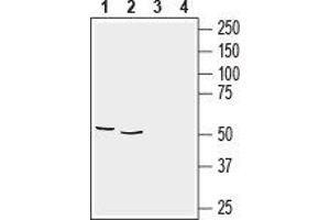 Western blot analysis of rat brain membranes (lanes 1 and 3), (1:2000) and mouse brain lysate (lanes 2 and 4), (1:400):1,2. (Glial Fibrillary Acidic Protein (GFAP) Peptid)