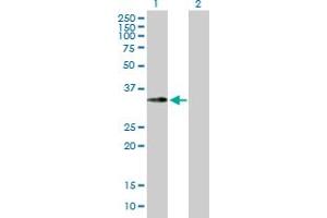 Western Blot analysis of EMD expression in transfected 293T cell line by EMD MaxPab polyclonal antibody. (Emerin Antikörper  (AA 1-254))