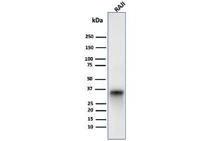 Western blot analysis of Raji cell lysate using CD74 Mouse Monoclonal Antibody (LN-2). (CD74 Antikörper)