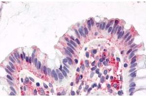 Immunohistochemistry (Formalin/PFA-fixed paraffin-embedded sections) of human colon, surface epithelium with GPR15 polyclonal antibody . (GPR15 Antikörper  (1st Cytoplasmic Domain))