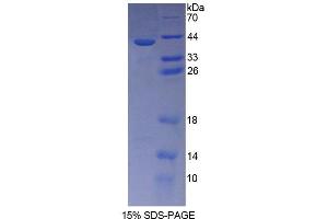 SDS-PAGE (SDS) image for Cadherin 5 (CDH5) (AA 69-391) protein (His tag) (ABIN4988686)