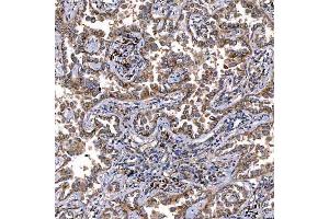 IHC analysis of TTC7B using anti-TTC7B antibody (ABIN7601050). (TTC7B Antikörper  (AA 275-730))