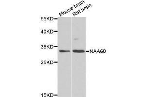 Western blot analysis of extracts of mouse brain and rat brain cell lines, using NAA60 antibody. (NAT15 Antikörper)