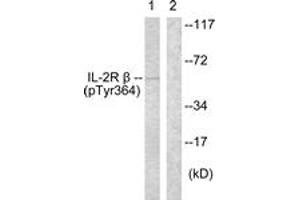 Western blot analysis of extracts from HeLa cells, using IL-2R beta (Phospho-Tyr364) Antibody. (IL2 Receptor beta Antikörper  (pTyr364))