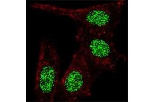 Fluorescent confocal image of HeLa cells stained with KLF4 antibody at 1:100. (KLF4 Antikörper  (AA 481-504))